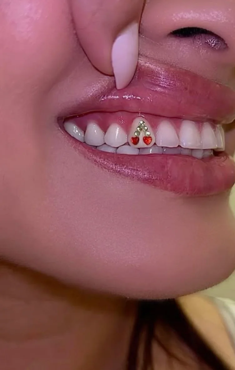 Cherry tooth gem design by Supreme.Gemz