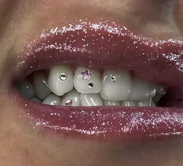 Star tooth gem design by Supreme.Gemz